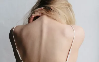 El esguince cervical en un accidente de tráfico